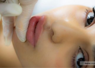 Botox dan Filler, Mana Yang Lebih Baik Untuk Kamu