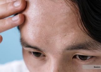 Berkeringat Ketika Tidur Bisa Jadi Pertanda Penyakit! Simak Ulasannya Berikut Ini!